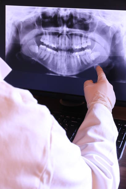 Best Emergency Dentist for Lost Fillings or Crowns in Fmington, AR