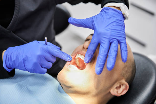 Best Emergency Root Canal Treatment in Fmington, AR